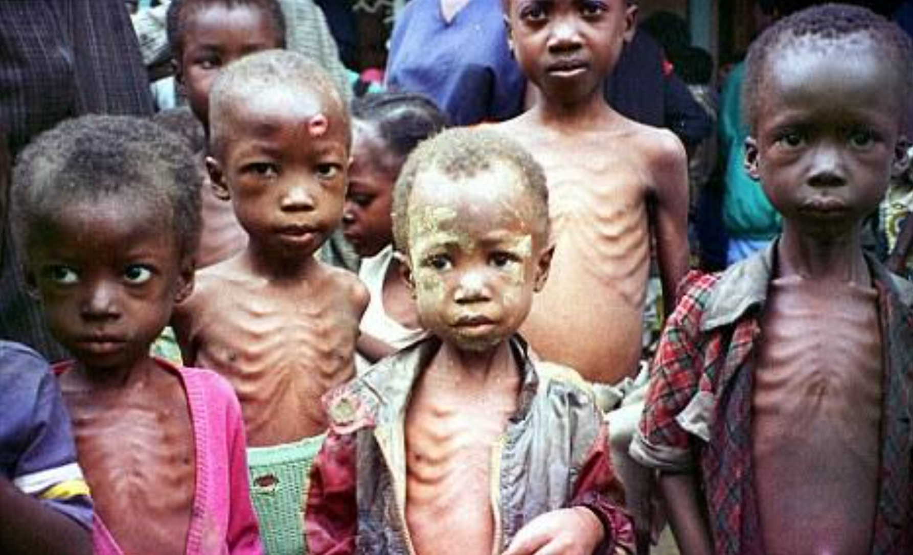 Russia “lets the Third World starve” because the grain deal with Ukraine failed. But why aren’t the poorest of the poor protesting?