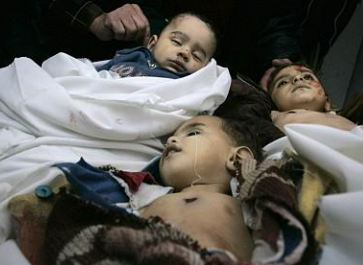 Warning: This Interview Features Graphic Images of a British Doctor Trying to Save the Lives of Civilians in Gaza who were Severely Injured and Deformed by Israeli Bombs.
